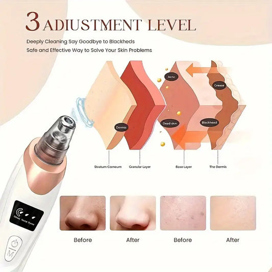 3-Adjustable Level Blackhead Remover Pore Vacuum, Upgraded USB Rechargeable Face Pore Acne Cleaner with 5 Probes for Women and Men, Suitable for All
