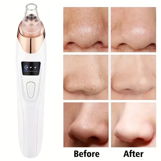 3-Adjustable Level Blackhead Remover Pore Vacuum, Upgraded USB Rechargeable Face Pore Acne Cleaner with 5 Probes for Women and Men, Suitable for All